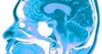 סריקת MRI של המוח. מתוך אתר מכון פרנקלין