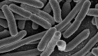 תמונת Escherichia coli תחת מיקרוסקופ אלקטרונים סורק