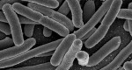 תמונת Escherichia coli תחת מיקרוסקופ אלקטרונים סורק