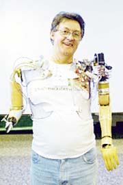 Jesse Sullivan with his bionic left arm