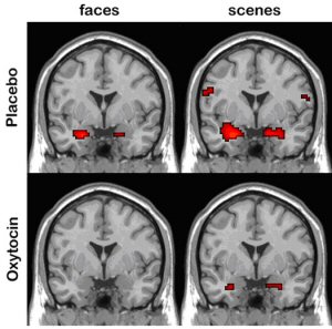 The effect of oxytocin on the brain
