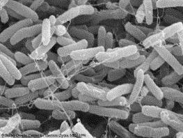 In the picture: the E coli bacterium - from now on it is also used as a computer's memory