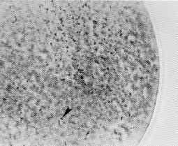 Wolbachia Wolbachia