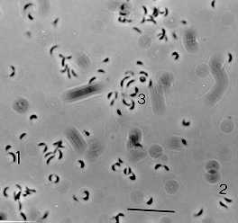 Caulobacter crescentus