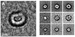 Right: circular structures formed by proteins associated with Alzheimer's and Parkinson's. Left: A similar structure formed by the amylin protein associated with adult diabetes