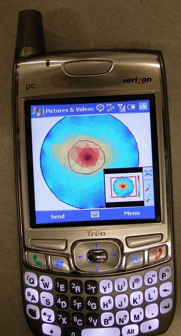 The medical imaging goes through the cell phone. Photo: Prof. Boris Rubinsky, Hebrew University