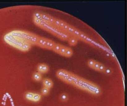 Staphylococcus aureus - bacteria that have developed resistance to antibiotics