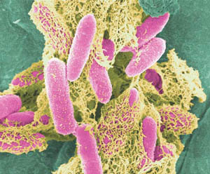 The E.COLI bacteria