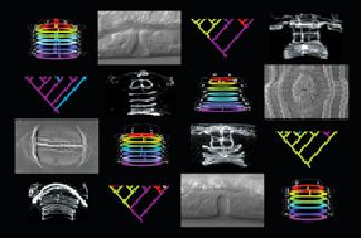 The variety of ways for the development of hyacinths in different types of nematodes