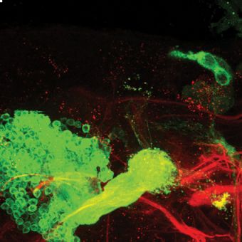 Normal and mutant neurons in the 24-h fruit fly pupal brain. In the normal brain, the axons undergo pruning at the point (marked by the arrow) where the main axon splits into two