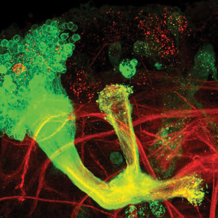 In the mutant brain, the mutation prevents pruning, so that the axons (marked by arrows) remain intact even after the splitting point