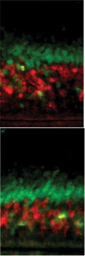 השוואה בין מוח של עכבר המייצר כמויות עודפות של החלבון LIS1 (מימין), למוח עכבר ביקורת המייצר כמויות רגילות של החלבון (משמאל). הצביעה הירוקה והאדומה מייצגת שתי שכבות שונות במוח העכבר. ניתן לראות, כי השכבה האדומה רחבה יותר בעכבר הביקורת, וכי סידור התאים בעכבר זה מאורגן יותר