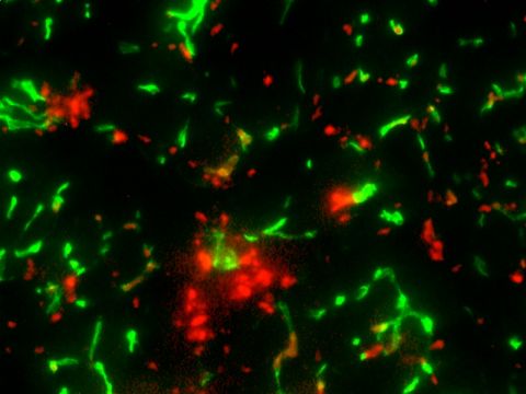 Bone marrow stem cells. Photo: Northwestern University