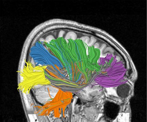 The current research is part of the effort to build the computer of the future: a machine that will simulate and imitate the operation of the brain and offer sensing, perception, interaction and cognition capabilities - all with extremely low current consumption, and in compact physical dimensions