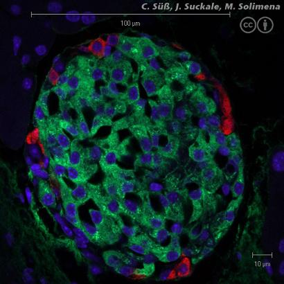 אי לבלב של עכבר, המכיל תאים מייצרי-אינסולין. אינסולין בירוק, גלוקגון באדום, גרעיני התאים בכחול. (מקור: ויקיפדיה)