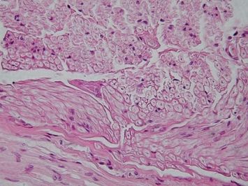 Cross section of a nerve cell. From Wikipedia