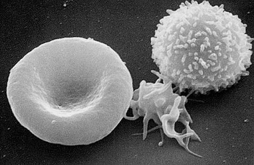 תאי דם - מימין לשמאל: תא דם לבן, טסית, תא דם אדום