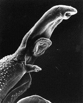 The bilharzia parasite. From Wikipedia, the source is free, from the US government