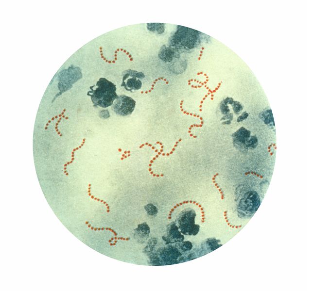 חיידק סטרפטוקוקוס