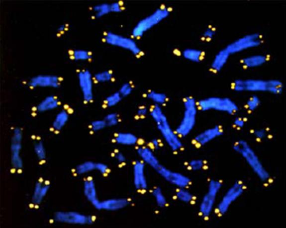 تنتهي الكروموسومات (باللون الأزرق) عند نهاياتها الواقية، والتي تسمى التيلوميرات (باللون الأصفر). التيلوميرات أقصر عند الأشخاص الذين يعانون من الإجهاد المزمن. تشير الأبحاث الجديدة إلى أن الكورتيزول مسؤول عن تقصير التيلوميرات المبكر