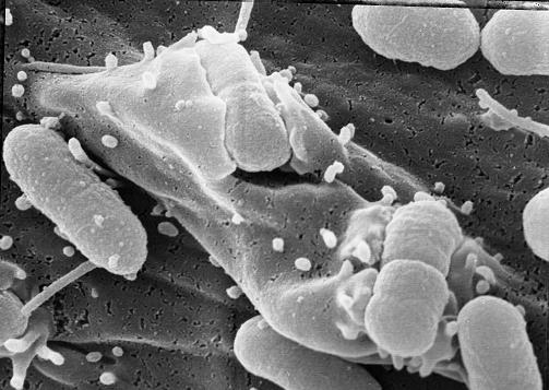 An image made with the help of a scanning electron microscope showing a bacterium with a cylindrical shape adjacent to the host cell. This bacterium is in the midst of the process of injecting toxins into the host cell