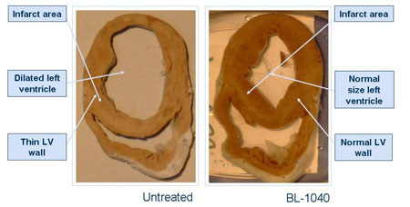 משמאל לב אחרי התקף ללא טיפול ומימין, עם טיפול ב-BL-1040