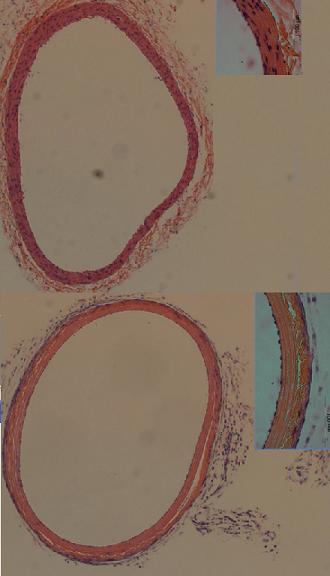 An artery treated with the IRE method (below) and an artery from the control group (photo courtesy of Prof. Rubinski)