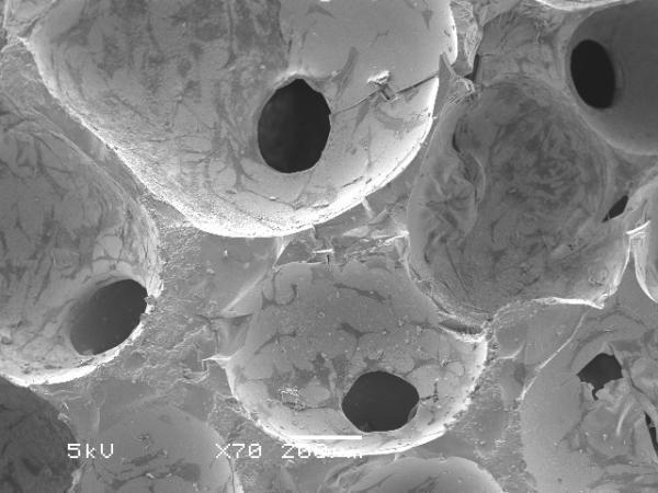 Bone cells growing on a bioactive glass substrate