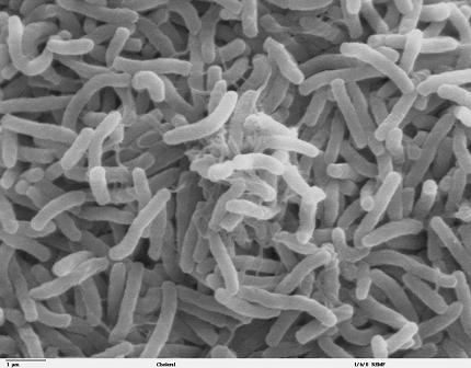 Vibrio cholera bacteria in a scanning electron microscope