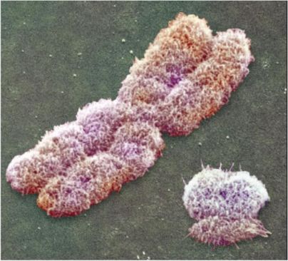 كروموسوم X (الكبير) وكروموسوم Y بجانبه