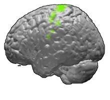 Fluid intelligence is an important part of IQ, and allows people to solve unfamiliar problems by understanding the connections between different ideas without prior knowledge or skill. The research shows that short-term memory training can improve fluid intelligence, something that was previously considered almost impossible.