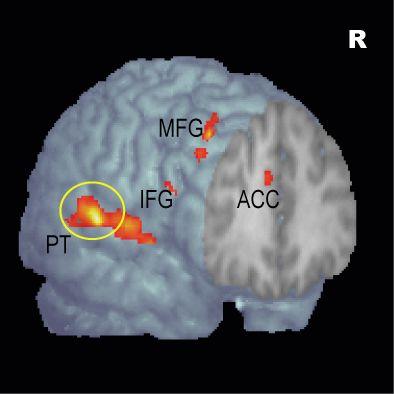 An area of ​​the brain that deals with spatial processing of background sounds