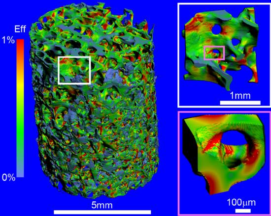 A highly advanced computer simulation of human bone structure, which will help in the diagnosis and treatment of bone thinning disease, as performed by IBM scientists with the help of the Blue Gene supercomputer