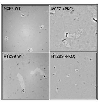 Cells with poor migration ability form a small "halo" (top left). Inserting a gene derived from metastatic cancer makes them more mobile, and their trajectory is clearly visible (top right). Conversely, cancer cells with a high migratory capacity (bottom left) in which the expression of the same gene is stopped, become stationary (bottom right)