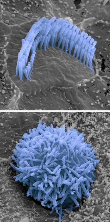 תמונת מיקרוסקופ אלקטרוני סורק של תאי שיער מאוזן פנימית של עכבר. למעלה: תא שיער מעכבר שומע למטה: תא שיער מעכבר חרש שחסר מיקרו-רנ''א בתאי השיער