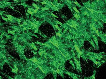 סיבי שריר של עוברי זבובים שמתפתחים בעוברים תקינים. רואים כי הסיבים התקינים מורכבים מתאים גדולים ורב-גרעיניים.