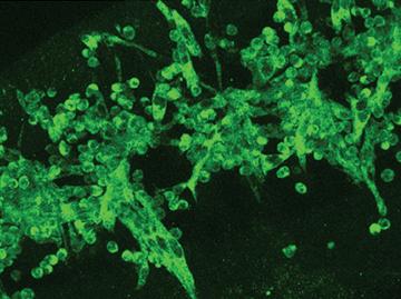 Muscle fibers of fly embryos formed in embryos lacking the gene encoding the WIP protein. The muscle fibers in the mutant embryos are thin and disorganized, as a result of failure of the muscle cells to fuse the founding muscle cells.