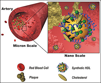 HDL - artificial good cholesterol