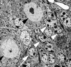 A clarified photograph of the cerebellum of a mouse using an electron microscope. The arrows point to the areas where the new nuclear molecule is located