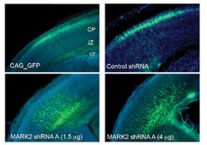 The staining of the nerve cells with a fluorescent substance makes it possible to follow the migration process. Above: In the control mice, the labeled cells reached the outer layer of the cerebral cortex. Bottom: Impairment of Par1 gene expression using high (right) or low (left) concentrations of short RNA molecules stops neurons halfway.