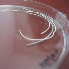 Composite fibers for the delayed release of drugs for the production of self-dissolving bandages. Photo: Prof. Mittal Zilberman, Tel Aviv University