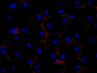 שיטות סינון גנטיות מראות כי הפטיטיס C מדביק תאים עם החלבון אוקלודין (באדום), ממצא המהווה קפיצת דרך משמעותית בפיתוח גרסה של הפטיטיס לבעלי חיים עם פטוגן אנושי ייחודי.