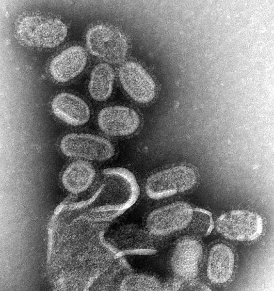 וירוס השפעת מוגדל פי 100,000 במיקרוסקופ אלקטרונים. תמונה מויקימדיה קומונס