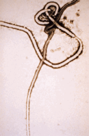 فيروس الإيبولا في المجهر الإلكتروني المخترق. الفيروس ذو مظهر ليفي، ويمكن أن يصل طول الألياف إلى 14,000 نانومتر في بعض الحالات. الفيروس مميت للغاية ومعدٍ للغاية. (ويكيبيديا)
