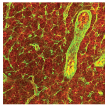 A cut in the lymph node, through which a blood vessel passes (marked by an arrow). The chemokines (in green) and the proteins to which the adhesion molecules adhere (in red) are found in the blood vessel wall, and network the tissue around it. The white blood cells respond to chemokines but ignore the proteins scattered in the tissue, and adhere only to those lining the blood vessels, where shear forces are applied.