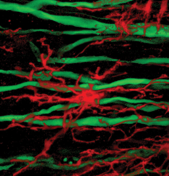 يؤدي العلاج بالكوباكسون إلى هجرة الخلايا المنتجة للميالين (الملونة باللون الأحمر) إلى المناطق المتضررة وتراكمها بالقرب من الخلايا العصبية (الملونة باللون الأخضر)