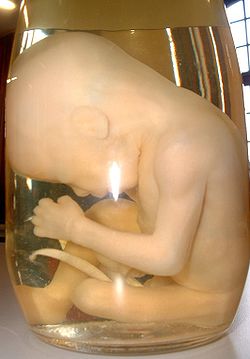 Human embryo, from Wikipedia