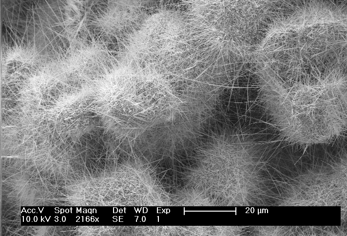 חומר הסיכה של אפננו, כפי שצולם במיקרוסקופ אלקטרונים במעבדתו של רשף טנא במכון ויצמן. צילום: מכון ויצמן