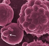 الخلايا البائية الصورة: جامعة بنسلفانيا