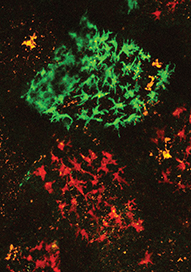 שתי שלוחות מעי סמוכות המכילות שתי קבוצות תאים דנדריטים (ירוקה ואדומה), שמקורן בשני תאי-אב מסוג מונוציט